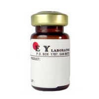 Pure Sambucus nigra (Elderberry Bark) -SNA-I